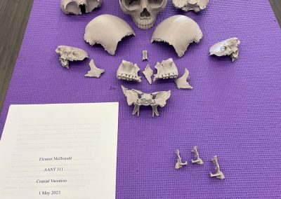 3D Scanning and Printing Cranial Bones